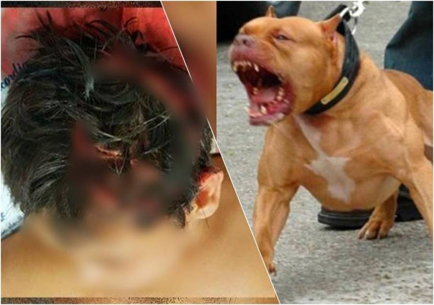 Imagem mostra como a cabeça de criança de 02 anos ficou após ser atacada por pitbull da família